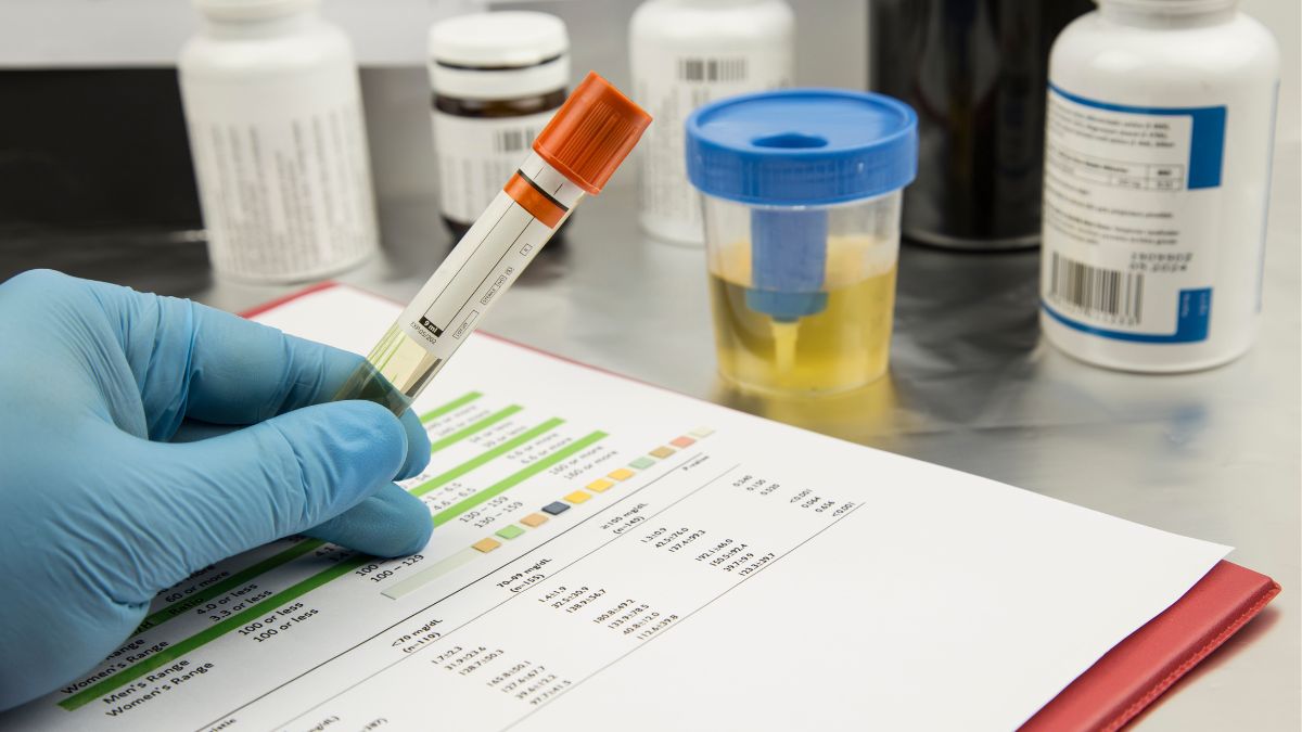 Una prueba de orina podría detectar cáncer