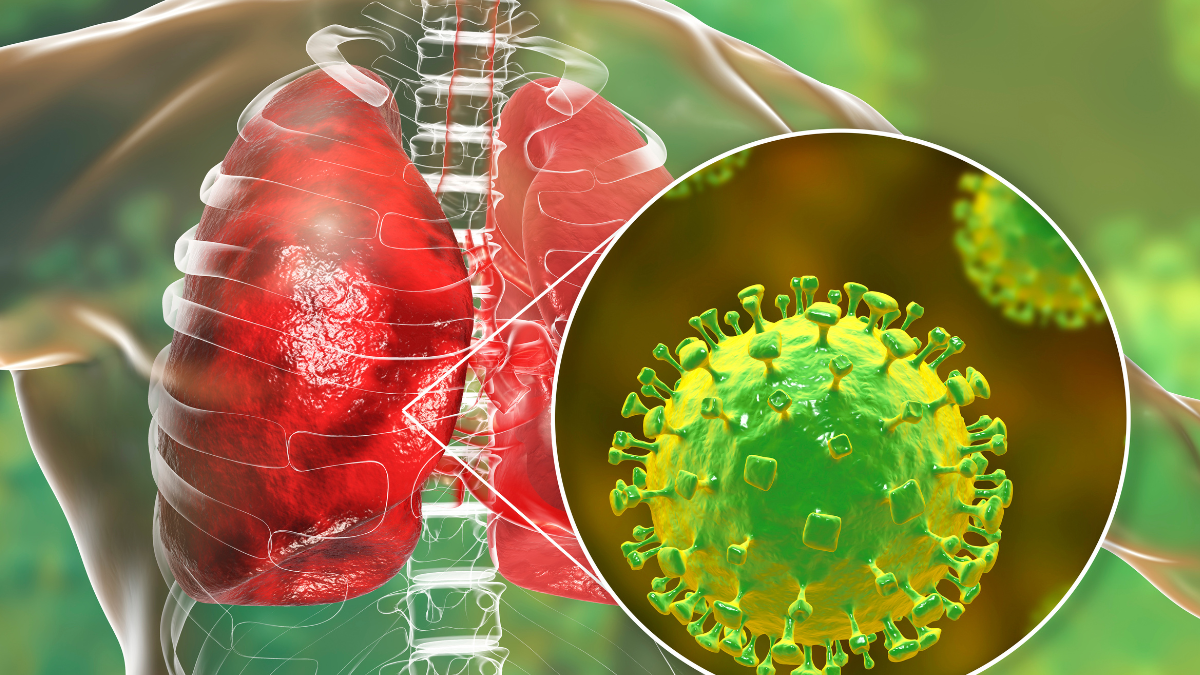 virus Nipah